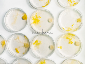 Physarum polycephalum_L4401