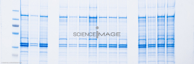 Electrophorèse_G2921
