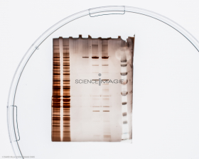 Electrophorèse_G2979