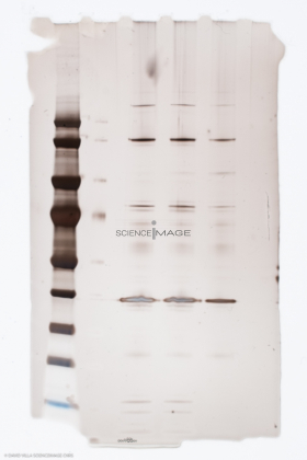 Electrophorèse_G3177