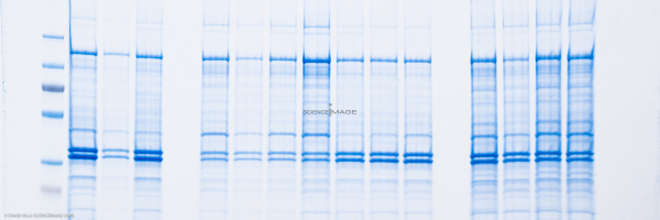 Electrophorèse_G2921