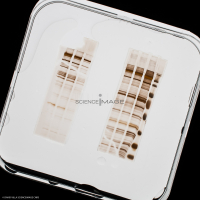 Electrophorèse_H3250