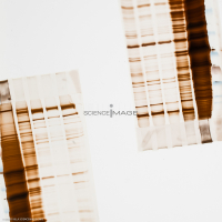 Electrophorèse_H3338