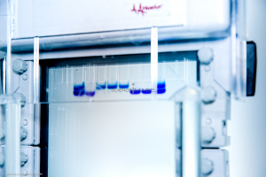 Electrophorèse_I3588