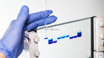 Electrophorèse_I3597