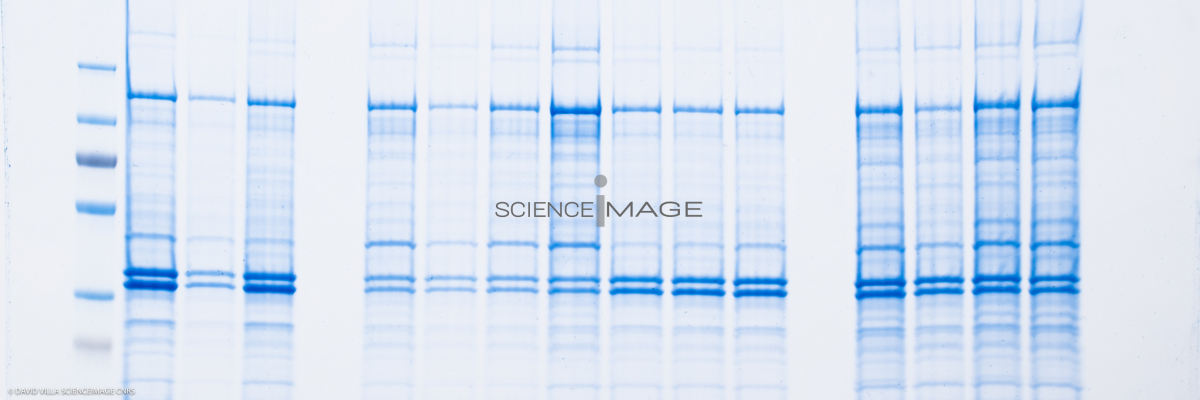 Electrophorèse_G2921