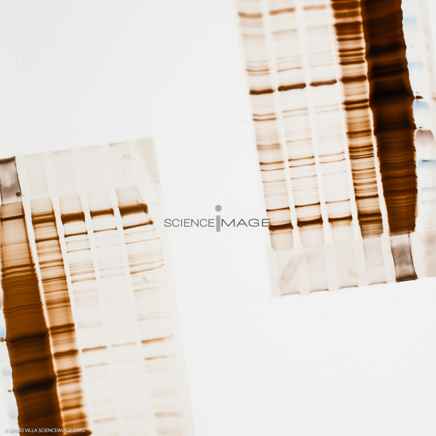 Electrophorèse_H3338